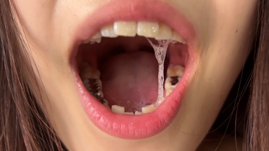 ツンデレ店員さゆりの口内に広がる唾液と銀歯が鼓膜を侵略する聴覚的屈辱 | Auditory Humiliation | АСМР Фемдом | 抖S音声