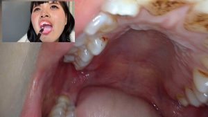 [あむの口腔内を至近距離で観察する残酷な聴覚支配の説明] | Auditory Humiliation | [АСМР Фемдом] | [抖S音声]