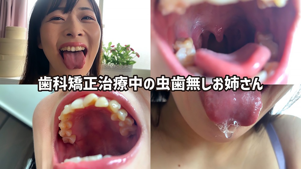 歯科矯正中の素人お姉さんみおりの口内観察と濡れた舌の動き | Oral Fetish Visual Humiliation | АСМР Фемдом | 口内観察