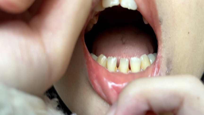 Unpolished Mouth Fetish Amu / 手入れの不行き届きな口腔内を晒される素人女子の屈辱的状況 | Absolute Obedience | 抖S音声